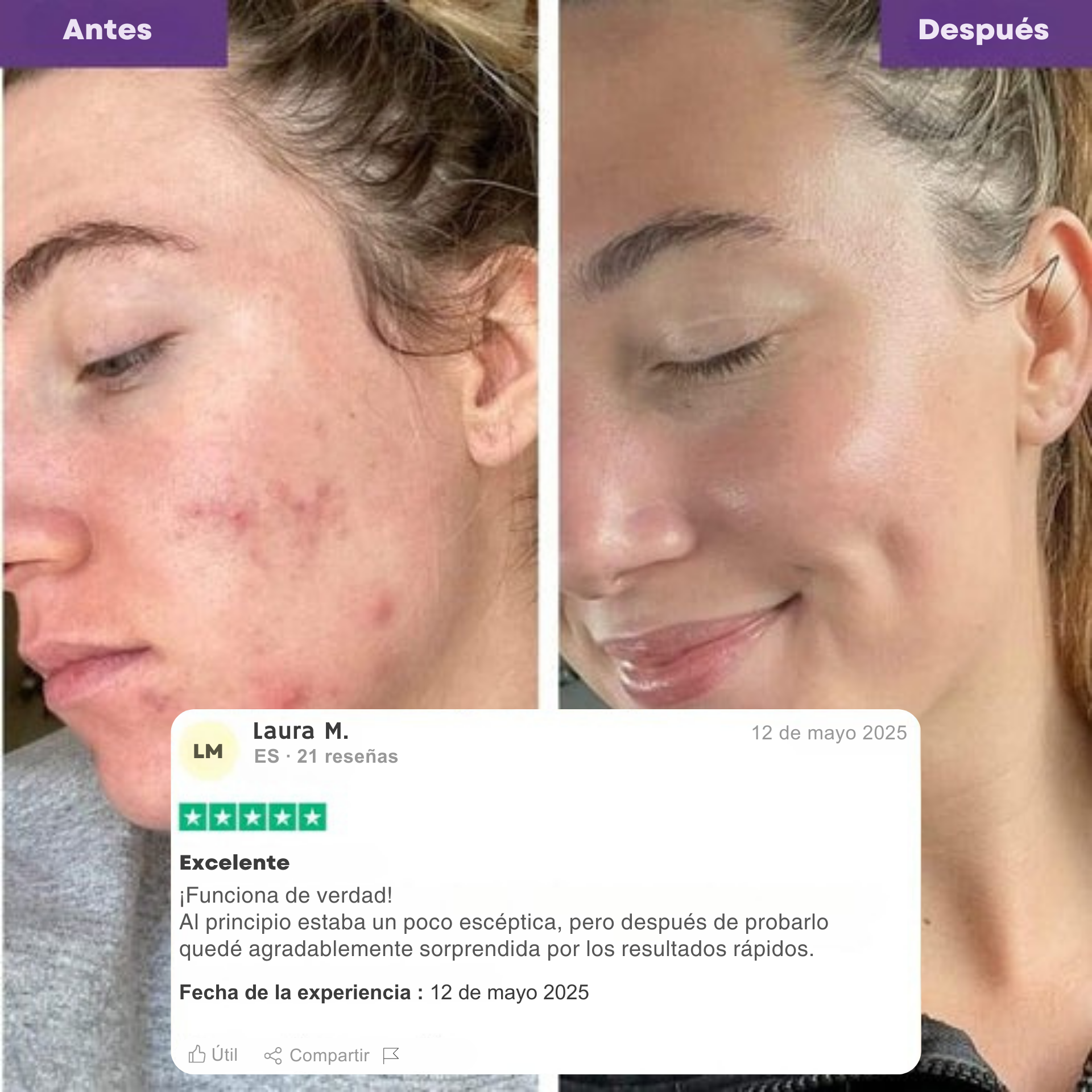 Ovaïa – Mascarilla Coreana con Cúrcuma y Colágeno